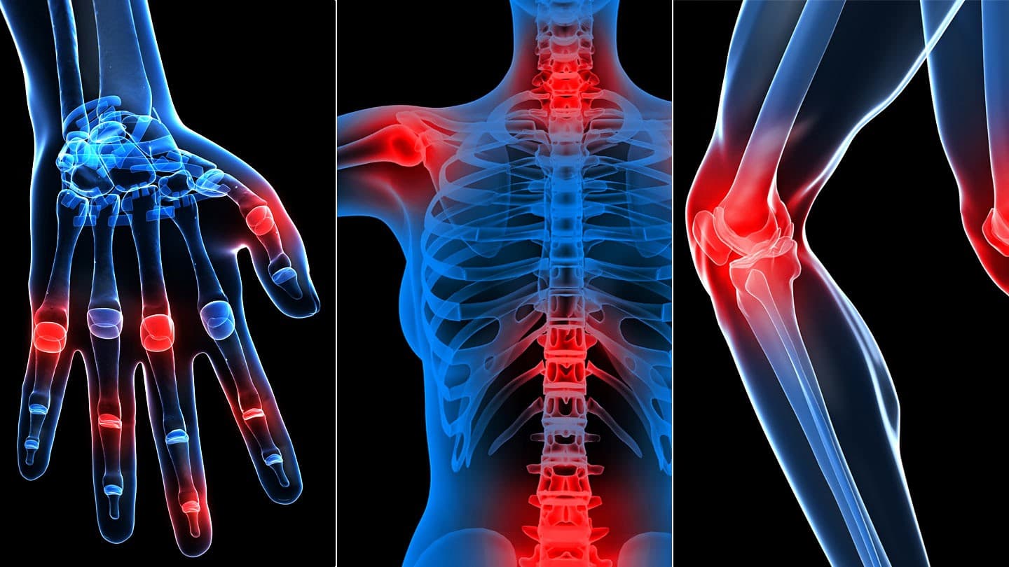 Rheumatology